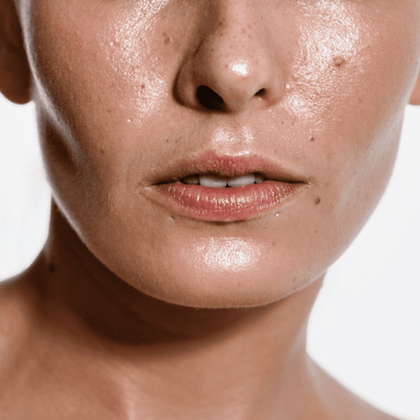 Skincare Picks For Oily Skin Type People To Control Your Oil Excess